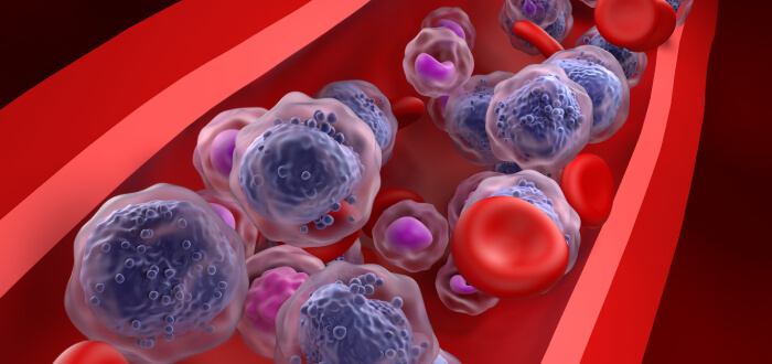 leukemia cells running through blood